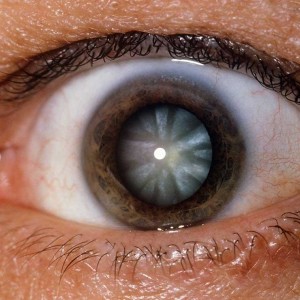 dark eyed people