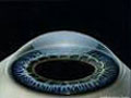 cornea-naslovna